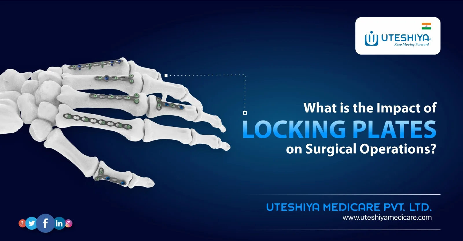 What is the Impact of Locking Plates on Surgical Operations